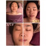 收細毛孔，只需七天 – Konni