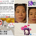 媲美醫美  改善顯老法令紋